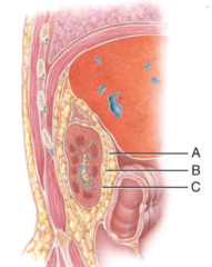 <p>b) B</p><p>—</p><p class="has-focus is-empty">A = Renal fascia</p><p class="has-focus is-empty">B = Adipose capsule</p><p class="has-focus is-empty">C = Renal capsule</p>