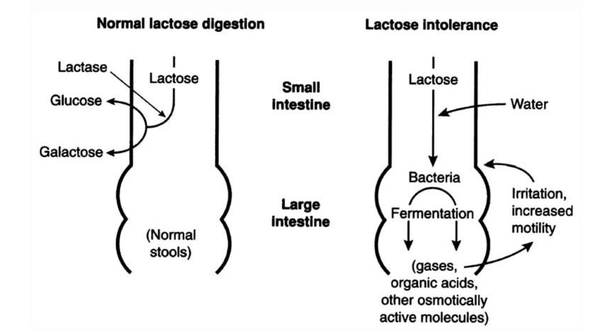 <ul><li><p>A Intolerance makes you fart a lot, you can just avoid lactose or take medication</p></li></ul><p></p><ul><li><p>Normally lactose is broken down into Glucose & Galactose in the <span style="color: rgb(13, 244, 10);"><strong>small intestine</strong></span></p></li></ul><p>_</p><ul><li><p>Lactose Intolerent people, cannot breakdown lactose and it ferments in the<span style="color: yellow;"><strong> large intestine by bacteria</strong></span></p></li></ul><p></p>