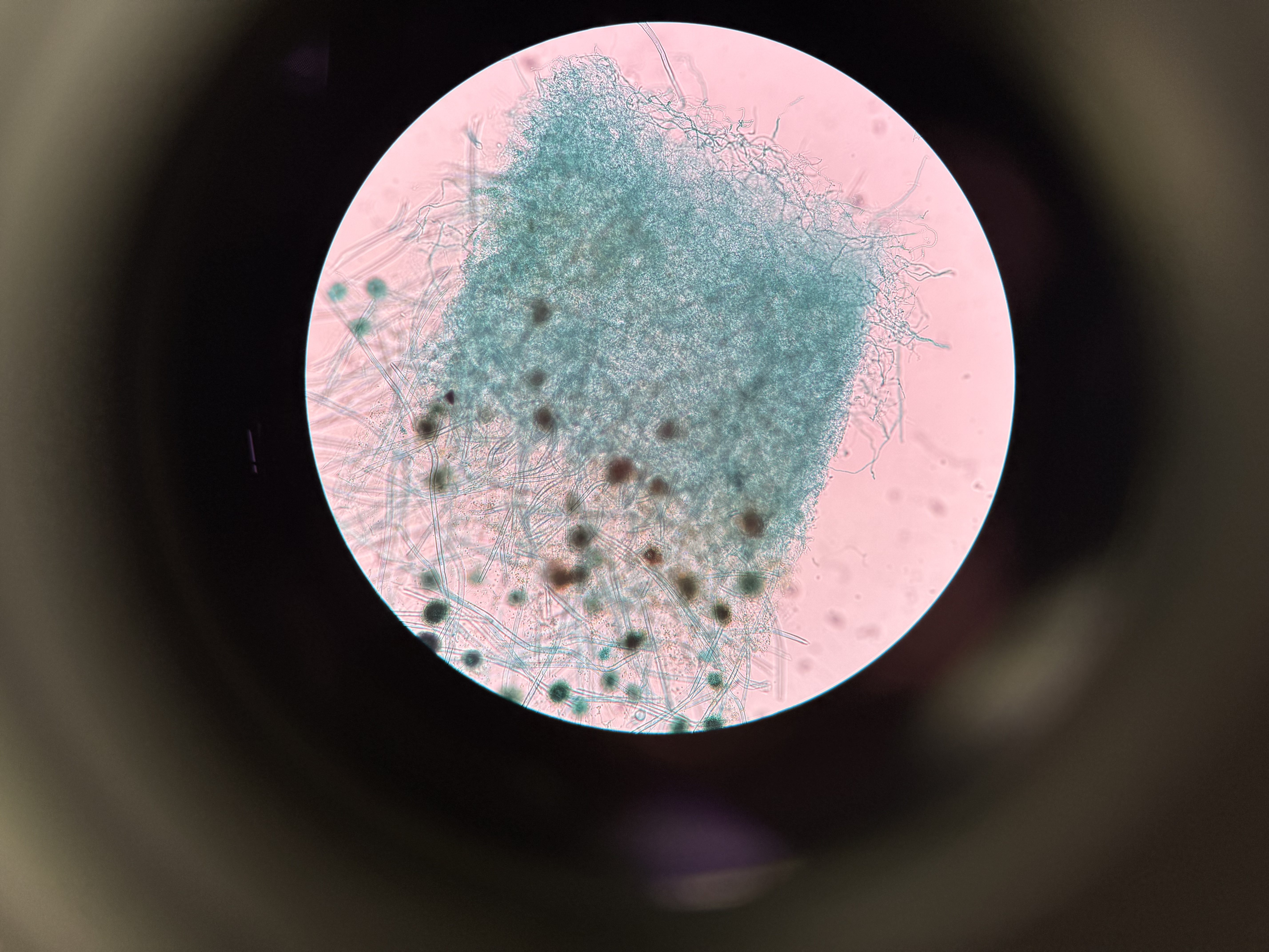 <ol><li><p>What is this?</p></li><li><p>What phylum?</p></li><li><p>Spore location?</p></li><li><p>What type of fungi?</p></li><li><p>What is the hyphae?</p></li><li><p>What is the conidiophores</p></li><li><p>What is the conidia?</p></li></ol><p></p>