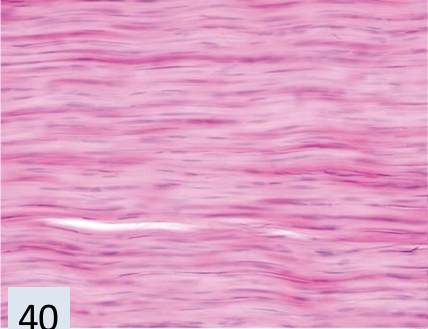 <p>what tissue is this? </p>
