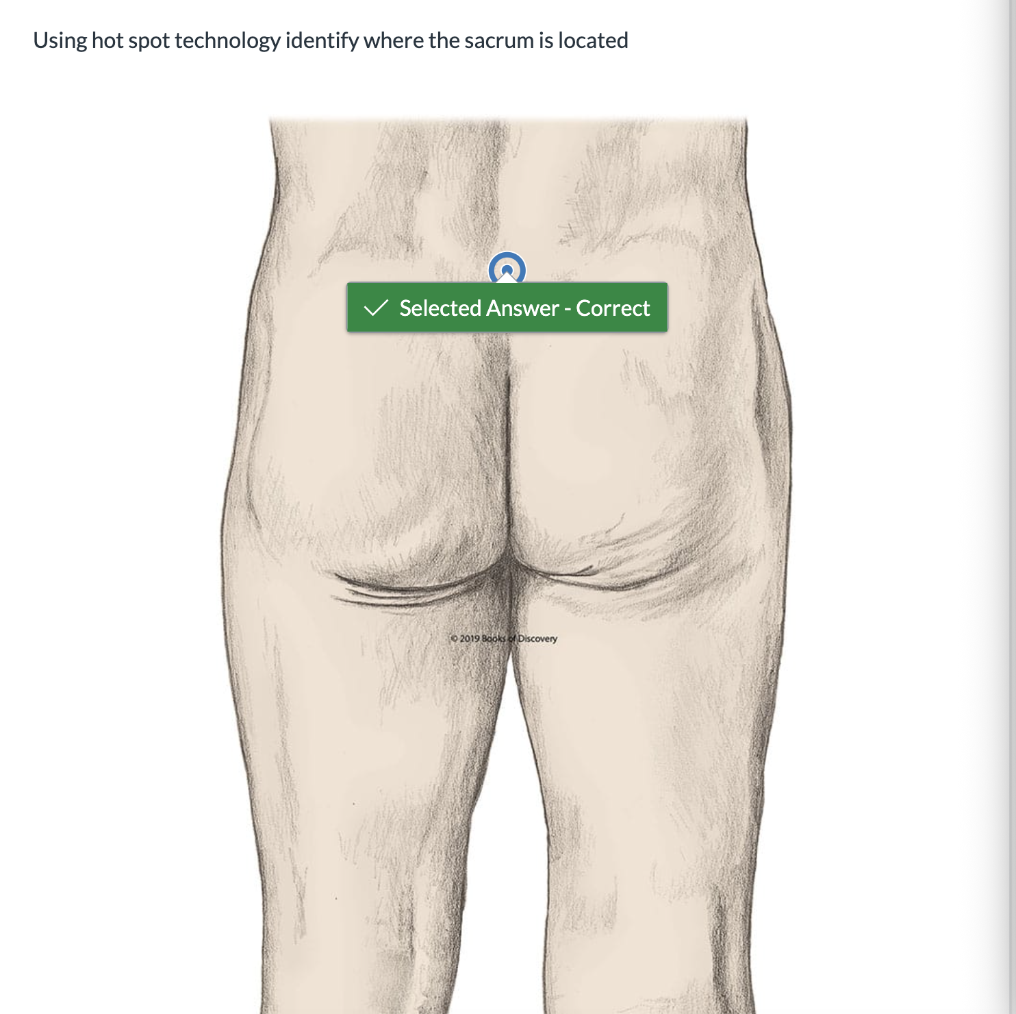 <p><span>Using hot spot technology identify where the sacrum is located</span></p>