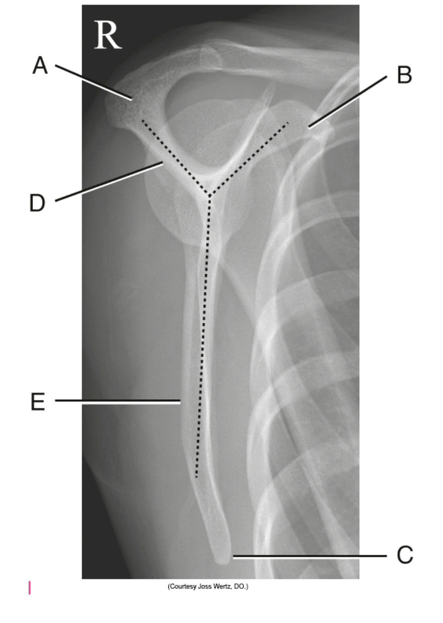 <p>B?</p>
