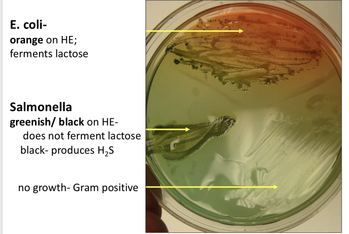 <p>Hektoen enteric agar (HE) results- <span><strong>Salmonella</strong></span></p>