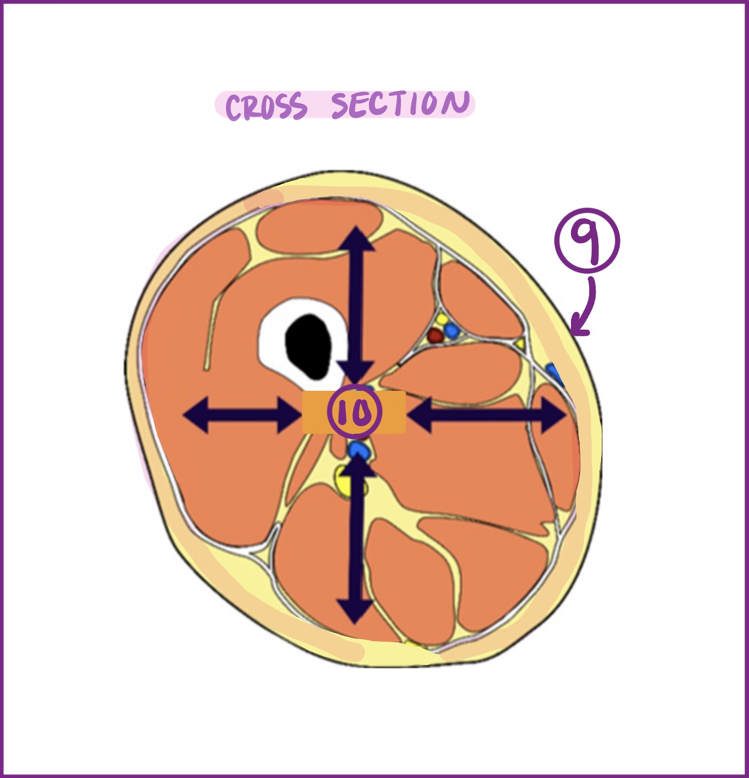 <p>#10 shows what anatomical direction?</p>