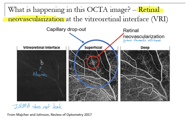 <p>A bundle of BV that go nowhere. </p>