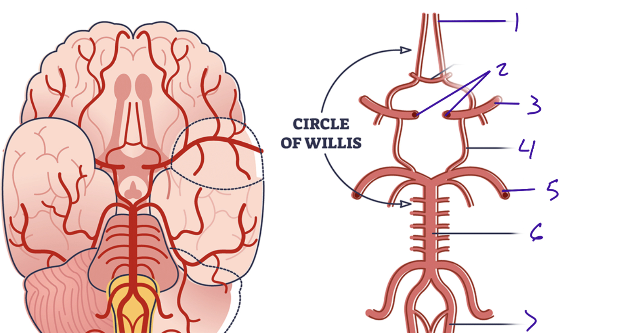 <p>Above the optic chiasm when looking inferior. #1</p>