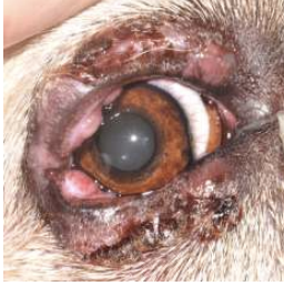 <p>What condition refers to swelling of the glands or ductal openings of the meibomian glands? It is treated with tetracycline antibiotics and corticosteroids, and there may result in a qualitative tear deficiency.</p>