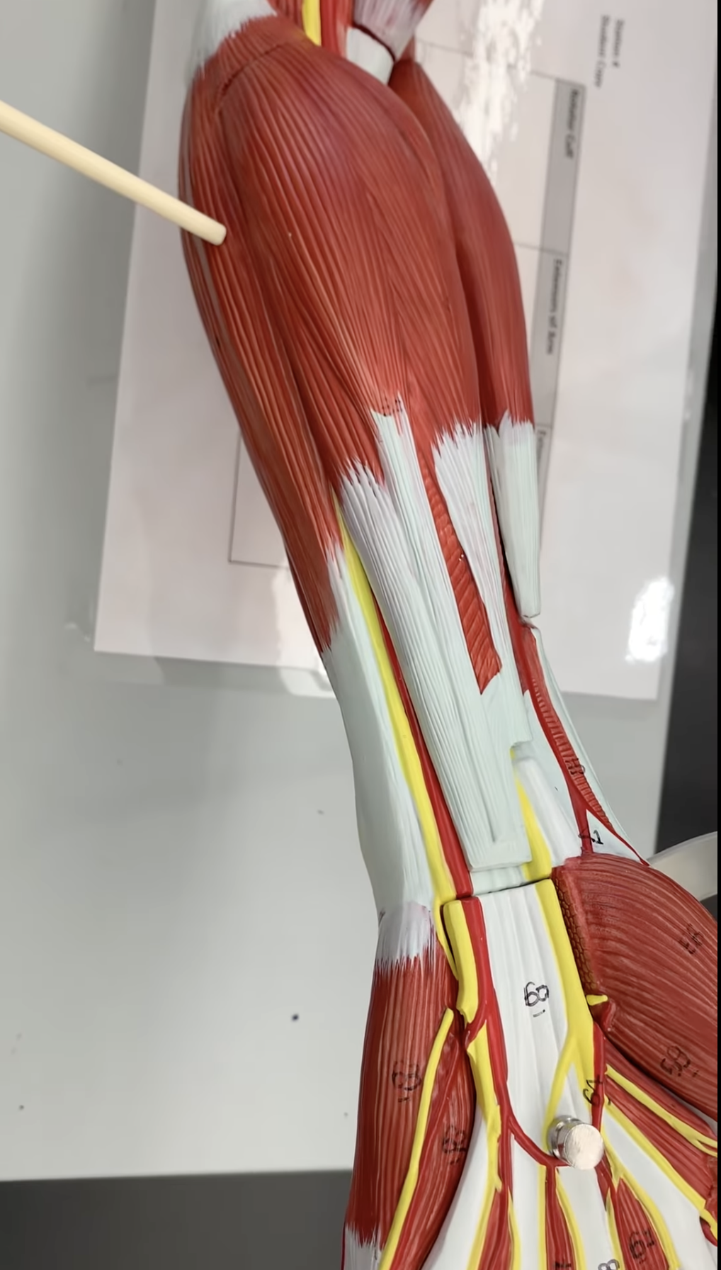 <p>Flexor Carpi Ulnaris</p>