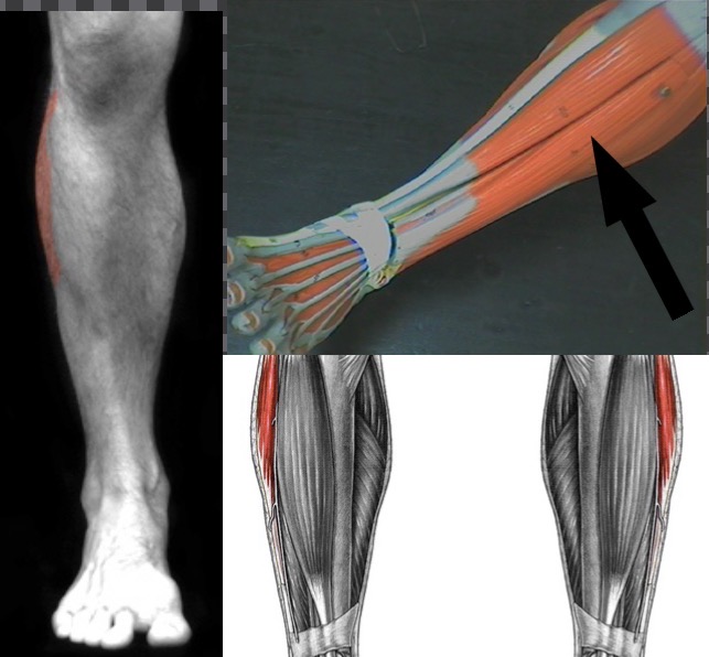 <p>What muscle is this?</p>