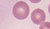 <p>What blood cell is this?</p>