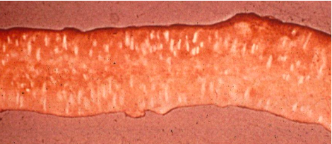 <p>Which Eimeria species creates white ladder regions in the duodenal loop?</p>
