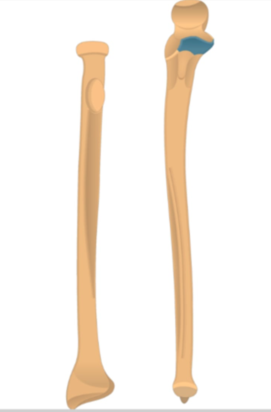<p>a triangular bony projection on the proximal <strong>ulna </strong>that serves as a crucial anterior stabilizer of the elbow joint</p>