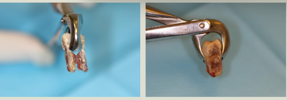 <p>both correct images</p><p>lower cowhorn forceps </p>