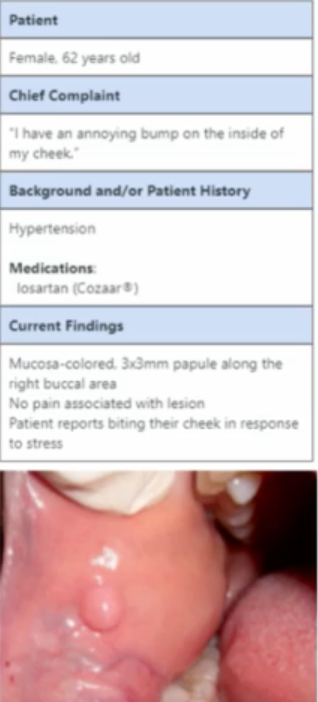 <p>whatt is the most likely ORIGIN of the lesion </p>