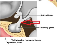 <p>how does the pituitary gland connect to the hypothalamus</p>