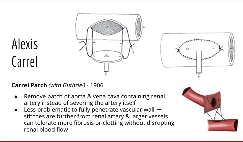 <ul><li><p>methods</p><ul><li><p>removal of a patch of the aorta and vena cava containing renal arteries</p><ul><li><p>used to prevent severying of the full artery</p></li></ul></li><li><p>it is less problamatic to fully penetrate the vascular wall</p><ul><li><p>stiches are futher from the renal artery and larger vessels = can toelrate more fibrosis or clotting without disrupting renal blood flow</p></li></ul></li></ul></li></ul><img src="https://encrypted-tbn0.gstatic.com/images?q=tbn:ANd9GcQw28Wj2OPbIf9nKq-TECFUxo6jaqvPVk1H3w&amp;s" data-width="100%" data-align="center" alt="Schematic representation of Carrel's patch technique for renal... |  Download Scientific Diagram"><p></p>