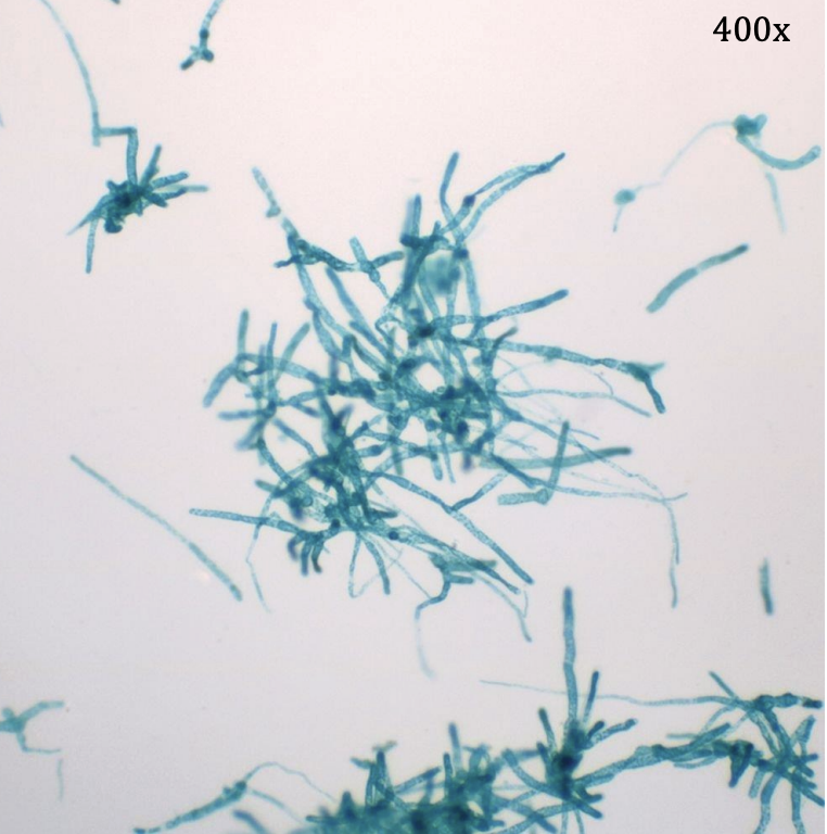 <p>Kingdom: </p><p>Phylum: </p><p>Name of Structure: </p><p>Ploidy: </p><p></p>