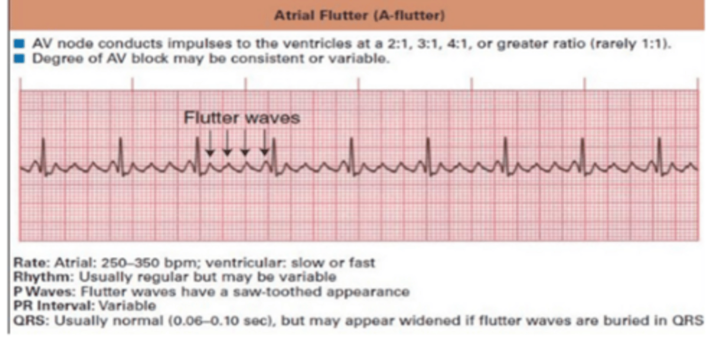 <p>250-350 bpm</p><p>- stop exercise if with symptoms</p>