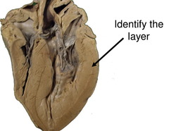 <p>Identify the structure</p>
