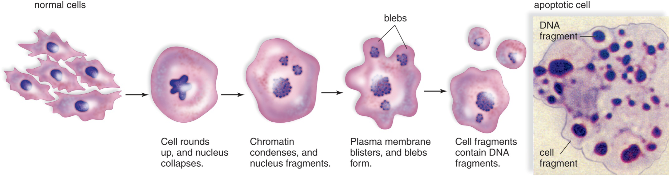 <p>Checkpoints are important because it will catch DNA damage, and the cell will try to <strong>repair</strong> them. If it is beyond repair, the cell will commit <strong>apoptosis.</strong></p><p><strong>Apoptosis: </strong>suicide of the cell, programmed cell death.</p><ol><li><p>Cell rounds up, chromatin condenses, nucleus fragments</p></li><li><p>Blebs form, and each cell fragment will contain some DNA fragments.</p></li></ol><p></p><p>Application: (triggered by a external signal)</p><p>•shaping organisms during development. eg. digits in hands, formation in womb</p><p>•limit spread of virus eg. immune cells death after eliminating pathogens</p><p>•prevent tumor development eg. cells with DNA damage</p><p></p><p><strong>Tumor Suppressor Genes: </strong>produce proteins that <strong>enforce checkpoints</strong>. Genes whose proteins inhibit cell division.</p>