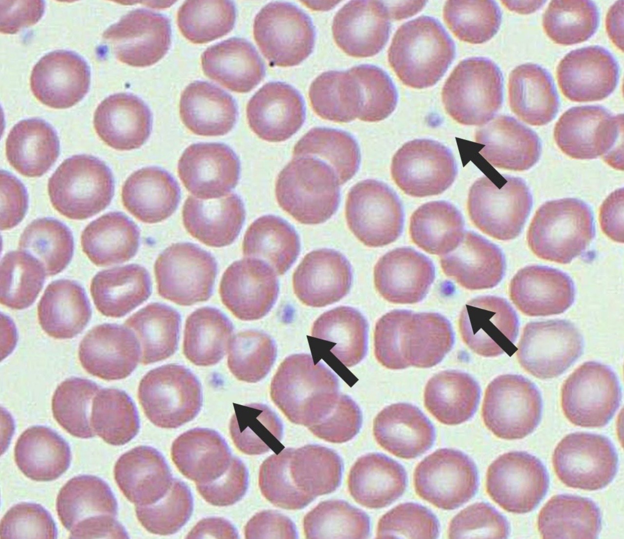 <p>Identify blood component</p>