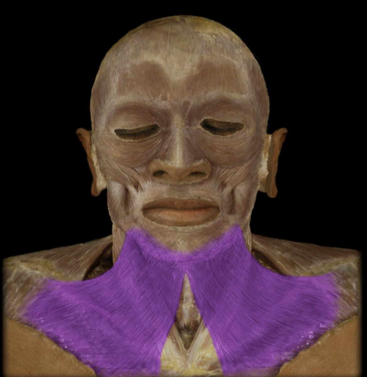 <p>What muscle is indicated in purple?</p>