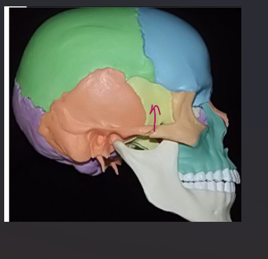 <p>What bone is this?</p>