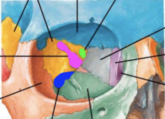 <p>What bone of the orbit is this? (lime green)</p>