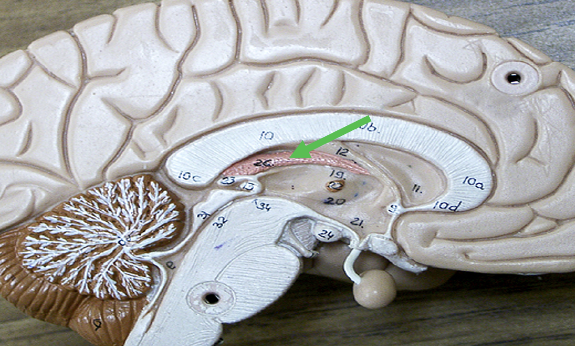 <p>Identify the area of the brain indicated by the pointer.</p>