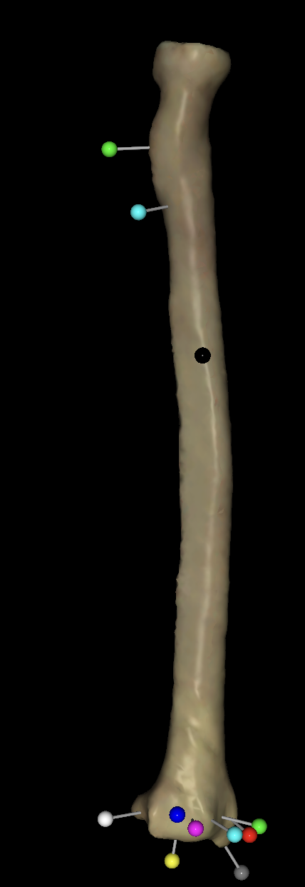 <p>What is the black tag of the right radius?</p>