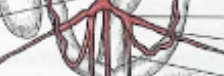 <p>left common iliac artery</p>