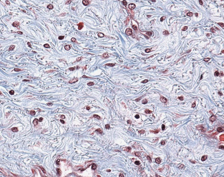 <p>what type of CT is this? be specific.</p>