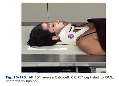 <ul><li><p>Angle CR 15 degree cephalic to OML: To accomplish this, first find the OML on the patient; this varies in patients in cervical collars with the neck extended. Then angle the CR 15 degrees cephalic to the patient’s OML, which will result in appearance of the CR close to a perpendicular beam relationship to the patient and the IR.</p></li><li><p>Center CR to nasion; then center IR to projected CR</p></li></ul><p></p>