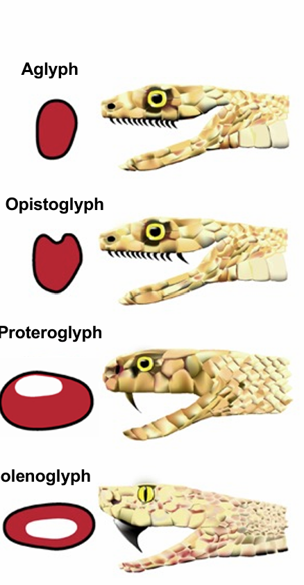 <ul><li><p><span><u>Aglyph</u>: nicht giftig (viele Nattern, alle Riesenschlangen)</span></p></li><li><p><span><u>Trugnattern</u> (opistoglyph): Zahn hinten im Kiefer vergrößert, mit Furche zur Leitung von Gift -> innere Blutung durch Blutgerinnungshemmer (Giftnattern)</span></p></li><li><p><span><u>Elapidae</u> (proteroglyph): festsitzender Giftzahn vorne mit fast geschlossener Furche zur Giftinjektion -> neurotoxisch, Lähmung (Taipane, Kobras)</span></p></li><li><p><span><u>Viveridae</u> (solenoglyph): herausklappbarer Giftzahn vorne mit geschlossener Furche zur Giftinjektion -> Blutgerinnungshemmer, Nekrosen, Lähmungen (Vipern, Klapperschlangen)</span></p></li></ul><p></p>