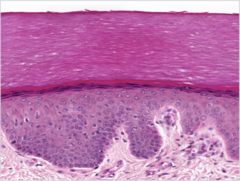 <p>Identify</p>