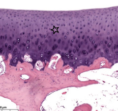 <p>How would you describe the staining of the starred tissue?</p>