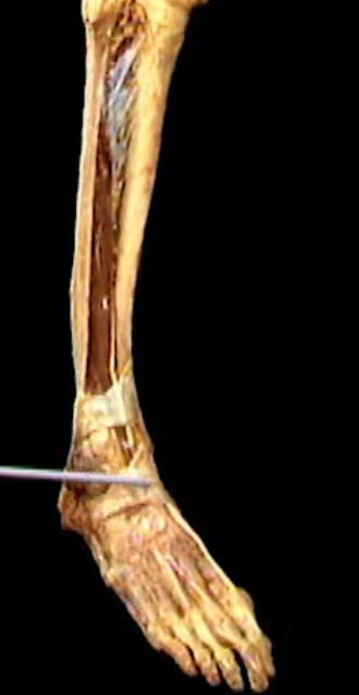 <p>Diep, Boven voet</p>