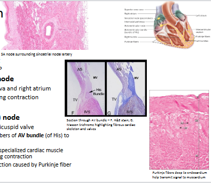 <ul><li><p><strong>Conducting system</strong></p><ul><li><p>Modified myocardiocytes</p></li><li><p>More slender and pale staining</p></li><li><p>Can generate and propagate AP</p></li></ul></li><li><p>Regulated by<strong> sinoatrial (SA) node</strong></p><ul><li><p>At junction of superior vena cava and right atrium</p></li><li><p>Spreads signal over atria, causing contraction</p></li></ul></li><li><p>Reaches <strong>atrioventricular (AV) node</strong></p><ul><li><p>Located in myocardium near tricuspid valve</p><ul><li><p>Sends signal via conducting fibers of <strong>AV bundle</strong> (of His) to heart’s apex</p></li><li><p>Signal spreads upward along specialized cardiac muscle fibers (<strong>Purkinje fibers</strong>) causing contraction</p></li><li><p>Premature ventricular contraction caused by Purkinje fiber action potential</p></li></ul></li></ul></li></ul><p></p>