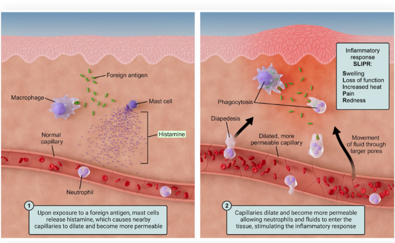 <p><strong>Leukocytes </strong>responsible for the first part of the inflammatory response</p><ul><li><p>Known as the <strong>rally signal</strong></p></li><li><p>Sit in the tissue in <strong>preparation </strong>for <strong>injury</strong></p></li><li><p>In the presence of injury, mast cells release <strong>histamine</strong>, which dilates blood vessels and increases their permeability, allowing immune cells to enter the tissue</p></li><li><p>Mast cells also release <strong>heparin</strong>, an <strong>anticoagulant </strong>that <strong>prevents blood clotting</strong></p></li></ul><p></p>