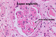 <p>Resolution: ~200 nm</p><p>Pros: Simple, widely available, live-cell imaging</p><p>Cons: Limited</p>