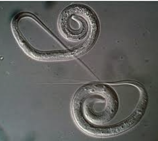 <p>infective stage is the L3 larva in infected copepods in drinking water. transmitted by drinking STAGNANT water containing infected copepods (cyclops). found histroically in west africa and india but now only in south sudan. sympt: asymptomatic for 10-14 moths bc worm produces morphine to mask migration, then blister forms with intense burning usually in the foot which leads to water exposure that triggers larval release. When a blister ruptures, the worm can be extracted by being wrapped around a stick.</p>