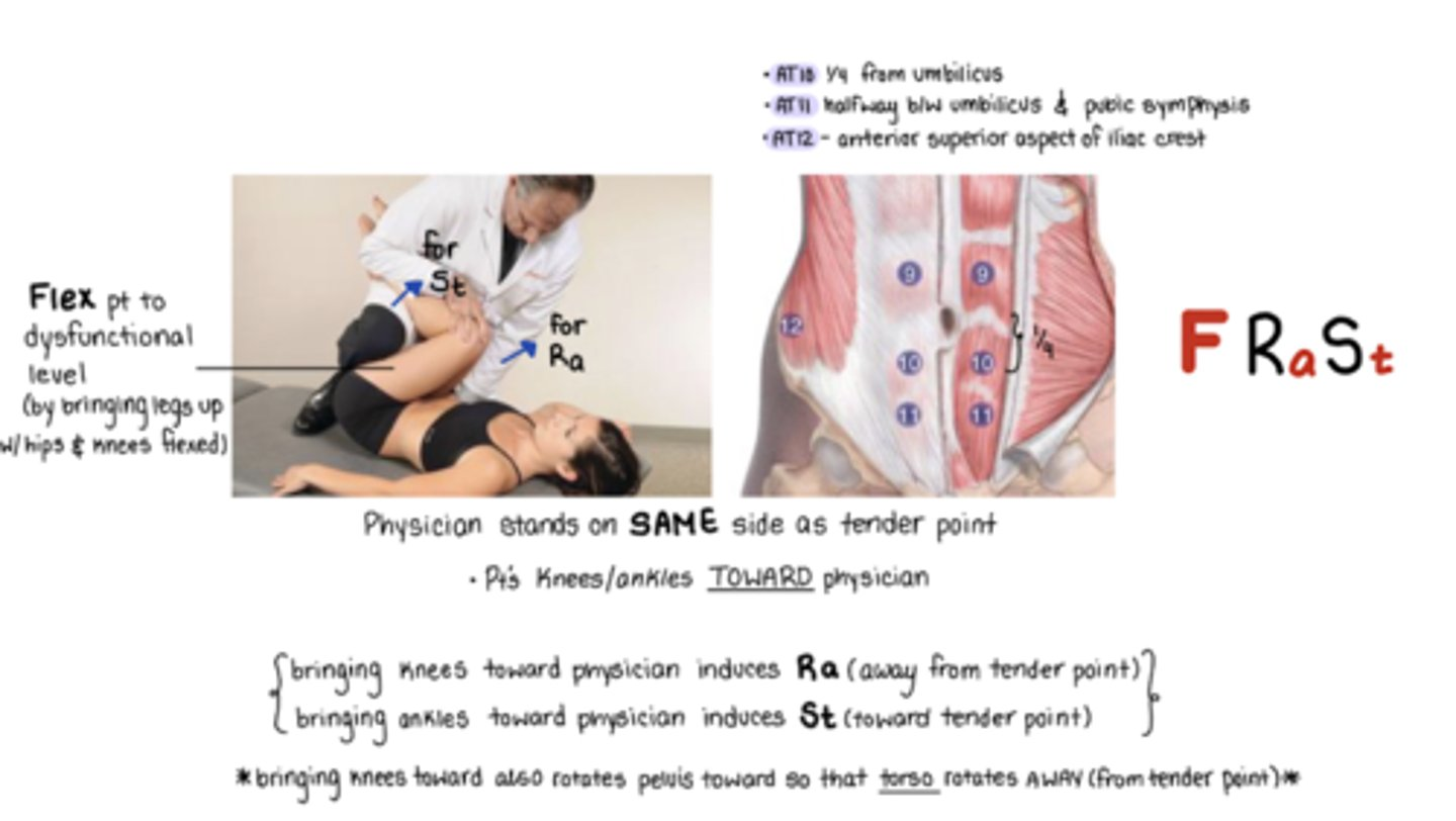 <p>Patient is supine for T1-6</p><ul><li><p>T1 = F (episternal notch)</p></li><li><p>T2 = F (angle of louis)</p></li><li><p>T3-6 = F to dysfunctional level</p></li></ul><p></p><p>Patient is seated for T7-9</p><ul><li><p>FStRa (slouch to F, move leg out to SB pt, pt wraps arms around leg to R)</p></li><li><p>use the OPPOSITE leg on table</p><ul><li><p>T7 = ¼ from xiphoid process</p></li><li><p>T8 = halfway xiphoid and umbilicus</p></li><li><p>T9 = ¼ from umbilicus</p></li></ul></li></ul><p></p><p>Patient is supine for T10-12</p><ul><li><p>FStRa (stand on same side, flex legs, knees and ankles to me)</p><ul><li><p>T10 = ¼ from umbilicus to pubic symphysis</p></li><li><p>T11 = halfway umbilicus and pubic symphysis</p></li><li><p>T12 = anterior superior aspect of iliac crest</p></li></ul></li></ul><p></p>