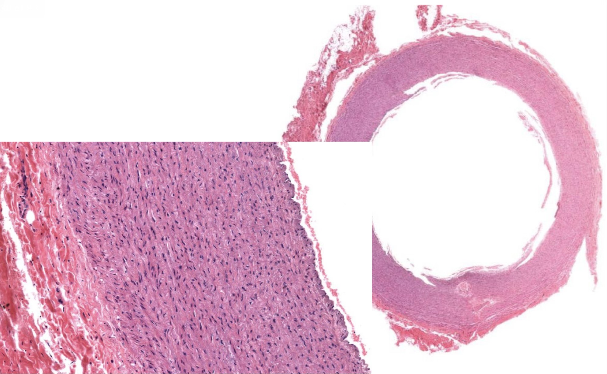 <p>Identify the Vessel and the Layer pictured</p>