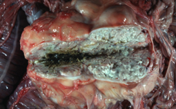 <p>diagnostico etiologico (linfonodo mesenterico)</p>