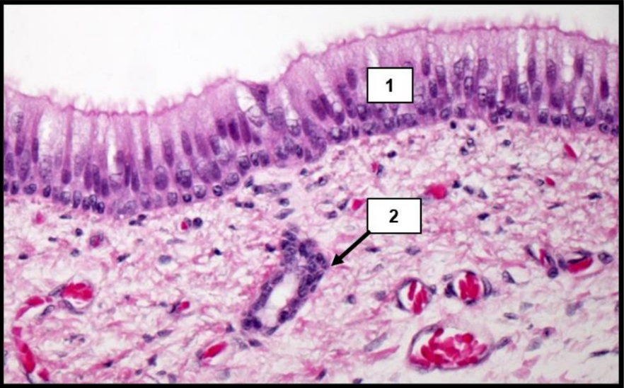 <p>Name the structure indicated by 1.</p>