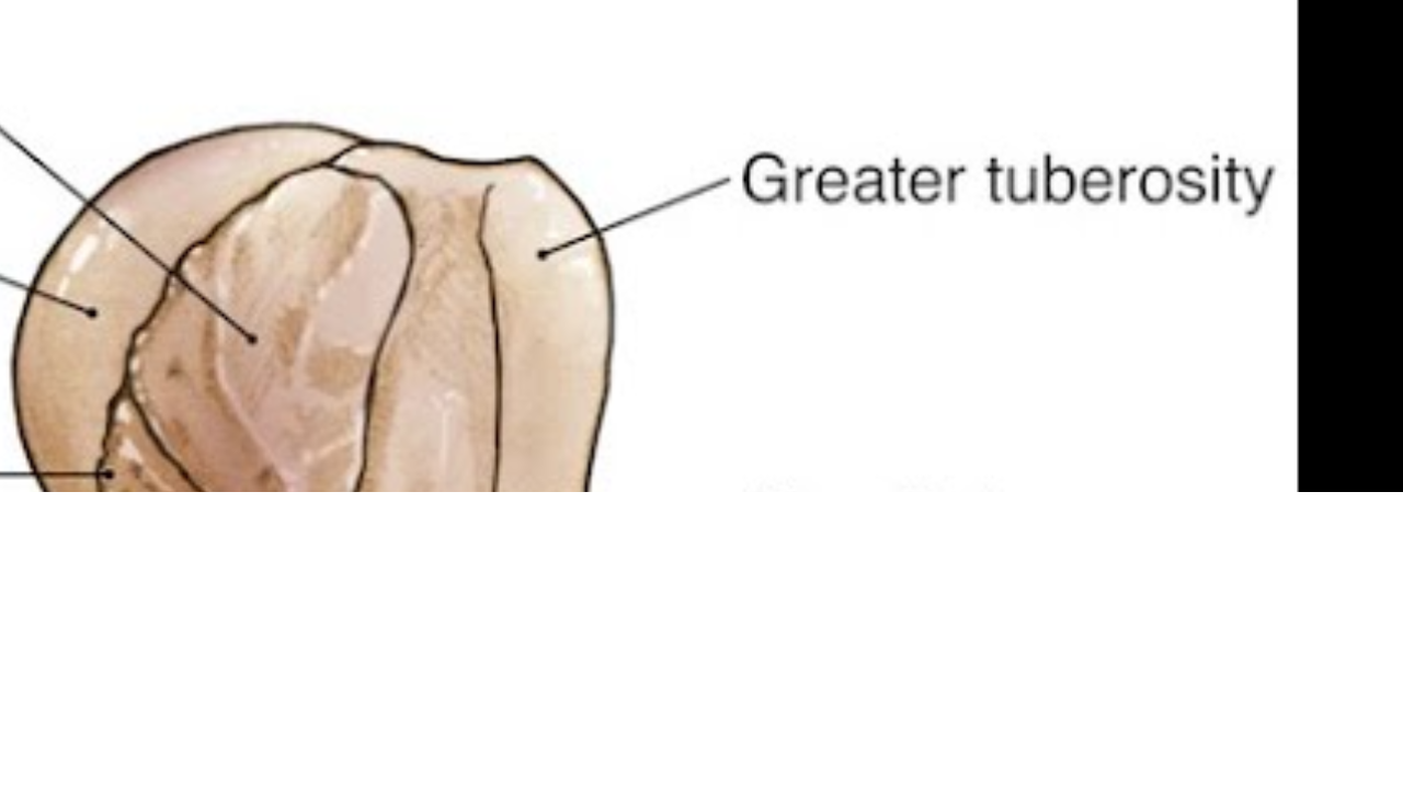<p>Greater Tubercle of Humerus </p>