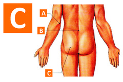 <p>Label "C"</p>