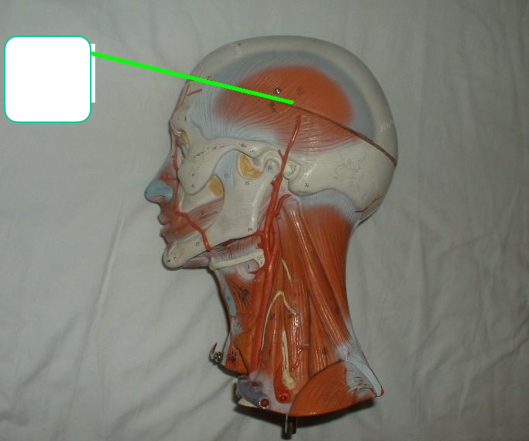 <p>over temporal bone </p>