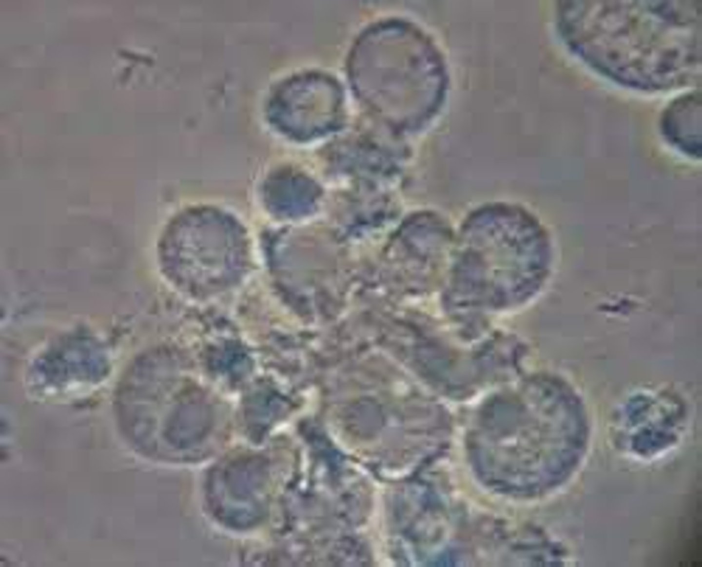 <p>Glitter cell</p>
