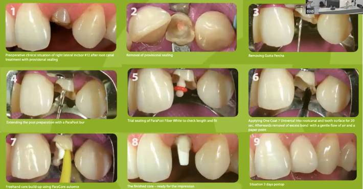 <p>What is the application procedure?</p>